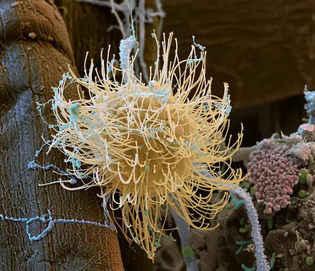 Foto: eye of sciences - Meckes &amp; Ottawa